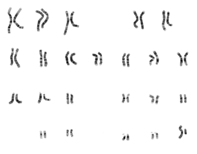 image of chromosomes