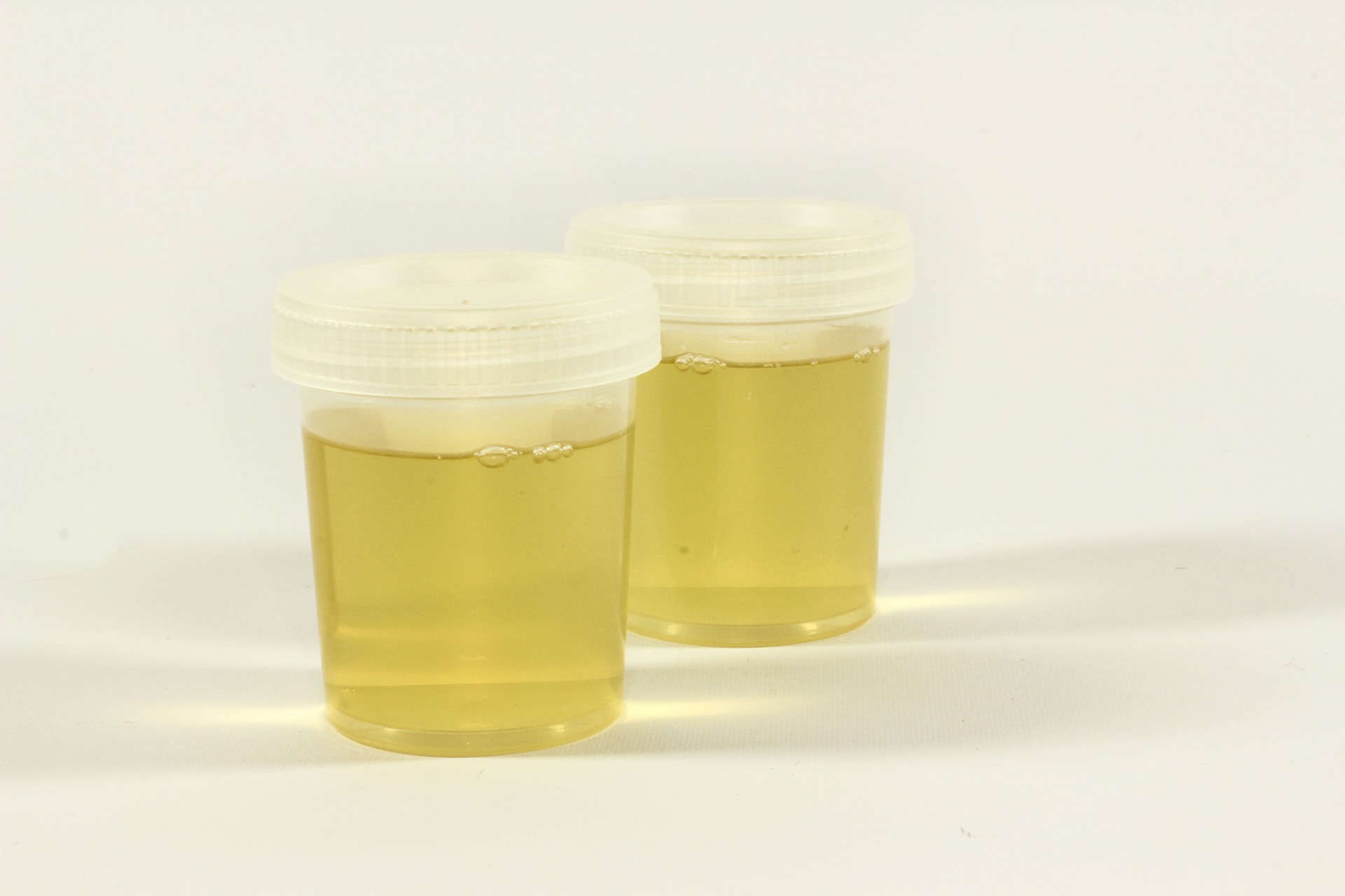 urine in plastic containers