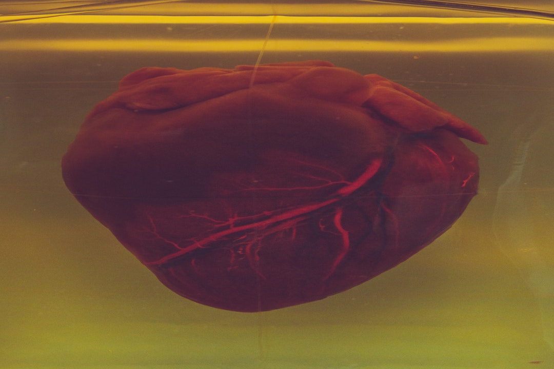 a human heart