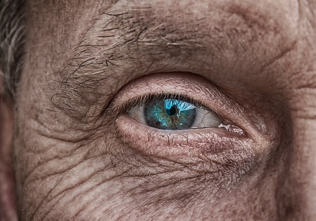 upclose image of an eye