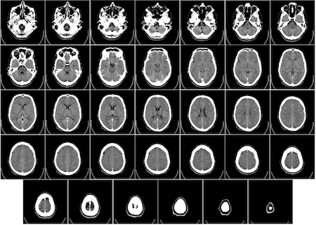 scans of the brain